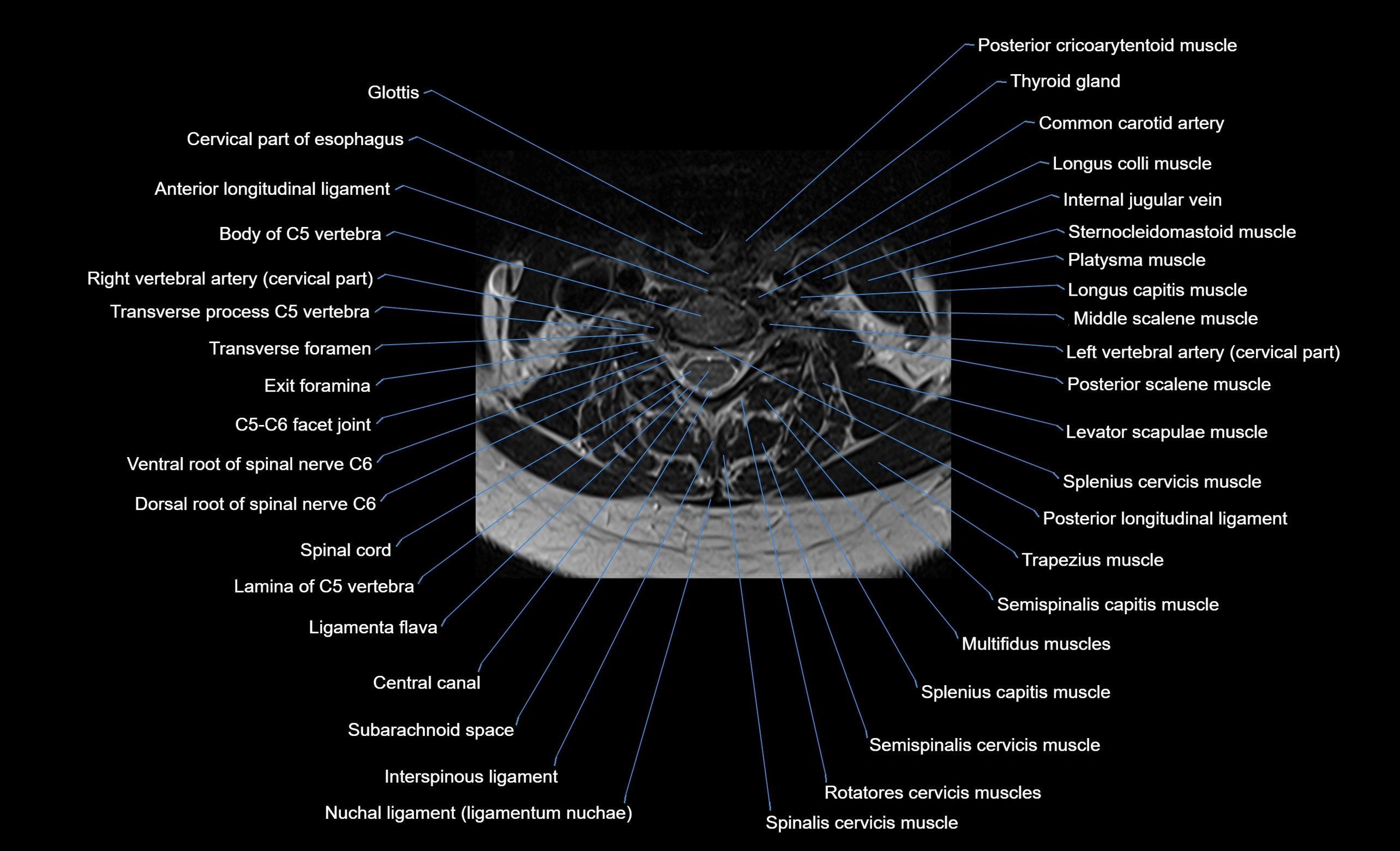 cervical spine cross sectional MRI anatomy  3T MRI axial  image-img-00001-00027.webp